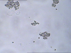 Kit d'essai de fonction de sperme de MARS IgA Test Kit IgA Antibody Coating Spermatozoa MARS